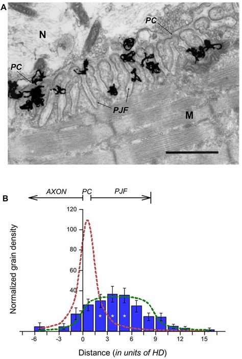 lack of acetylcholinesterase in the synaptic cleft|Fine Localization of Acetylcholinesterase in the Synaptic Cleft of .